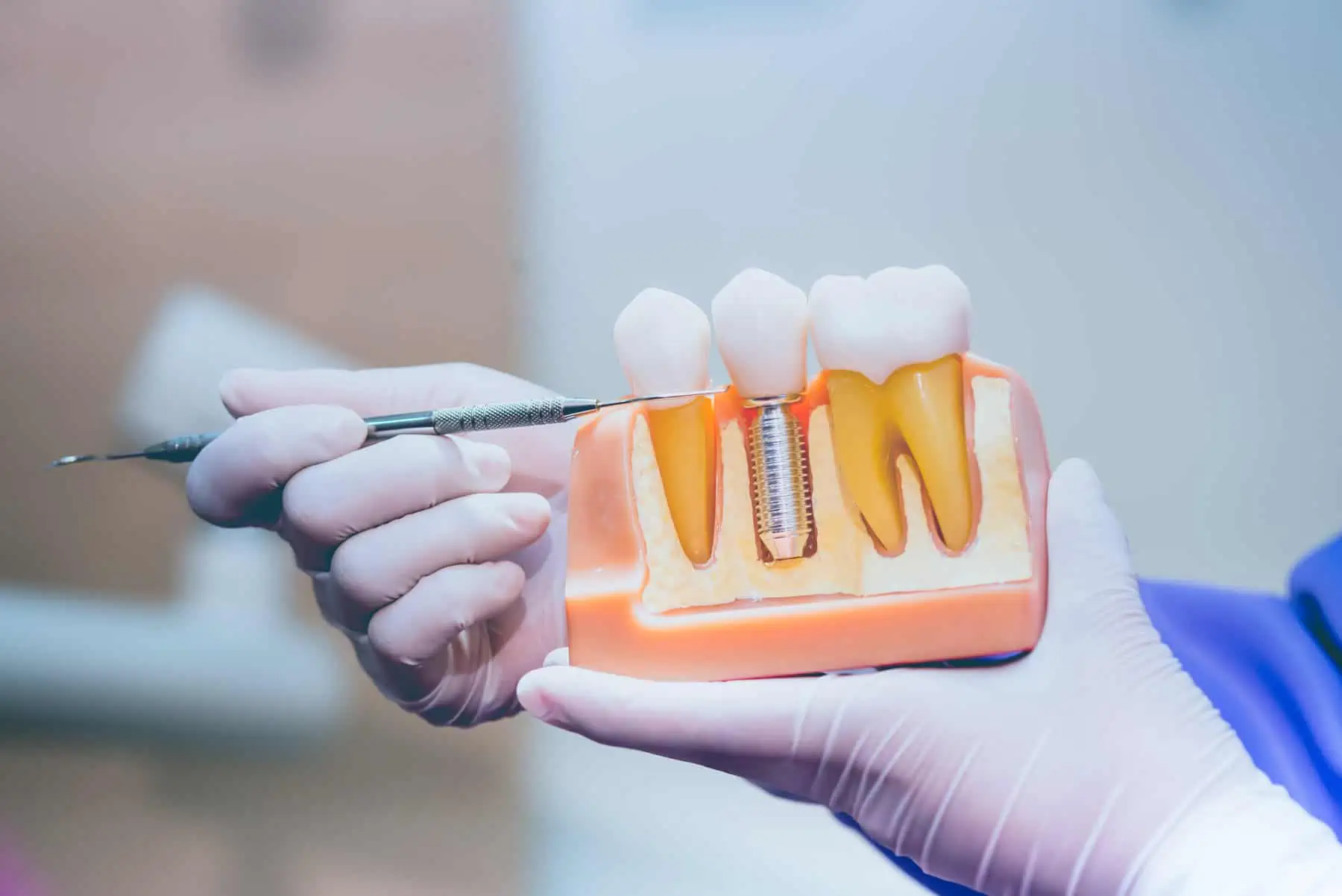 Dental implant surgery at Sea Pines Oral & Facial Surgery
